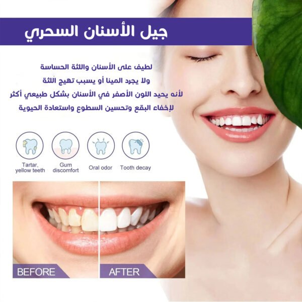 ⁦عرض 6 حبات جيل تبييض وتنظيف الاسنان السحري⁩ - الصورة ⁦3⁩