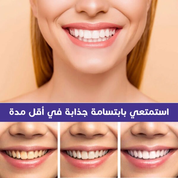 ⁦عرض 6 حبات جيل تبييض وتنظيف الاسنان السحري⁩ - الصورة ⁦4⁩